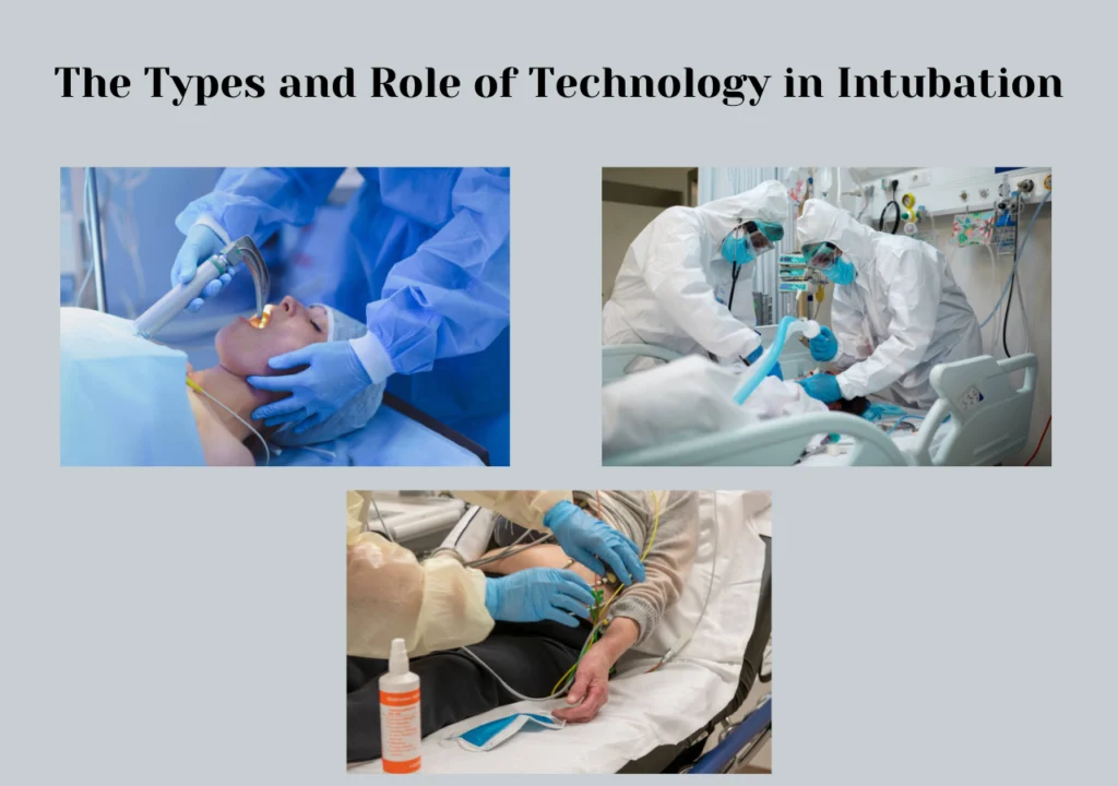 The Types and Role Facilities Using Cutting Edge Medical Technology for Intubation